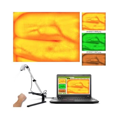 New Version Adjustable Adult Children Vein Viewer Display Infrare Lights USB Camera Imaging IV Medical Vein Finder