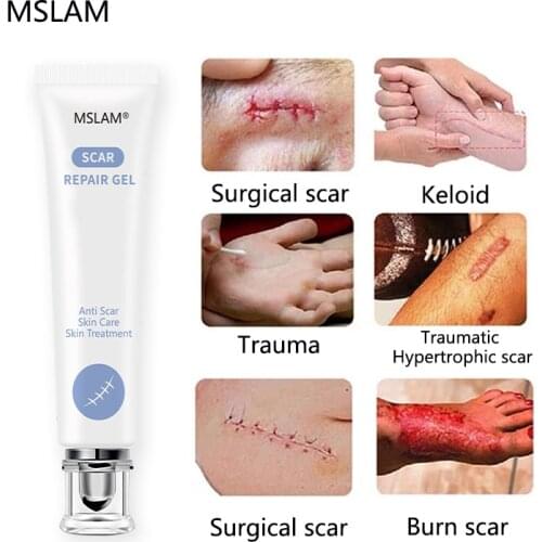 MSLAM Advanced Skincare Formula Scar Gel, Acne Scar, Burn Scar, Surgical Scar, C-Section Scar and Keloid Scar Treatment