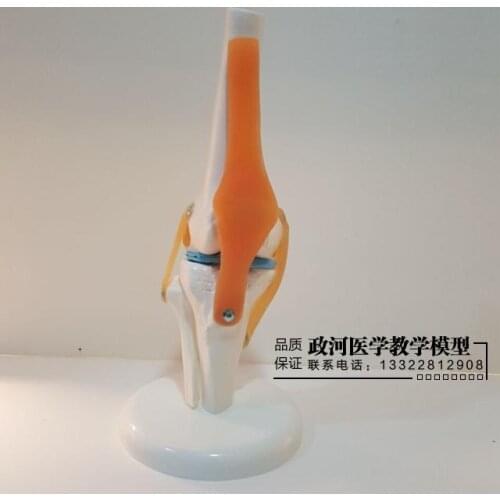 Human knee joint structure function model medical teaching model joint mold ligament