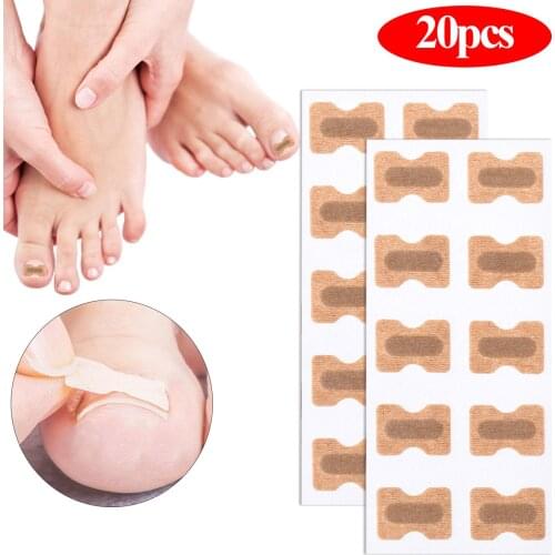 20/50/100pcs Nail Correction Stickers Ingrown Toenail Corrector Patches Paronychia Treatment Recover Corrector Pedicure Tools