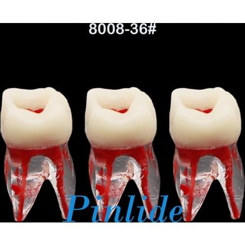 Dental RCT Practice Block Pulp Cavity M36# Molar Endo Root Canal Study Model 3Pcs