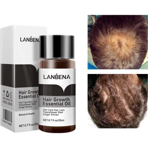 LANBENA Natural Fast Powerful Hair Growth Essence Anti Hair Loss Essential Oil