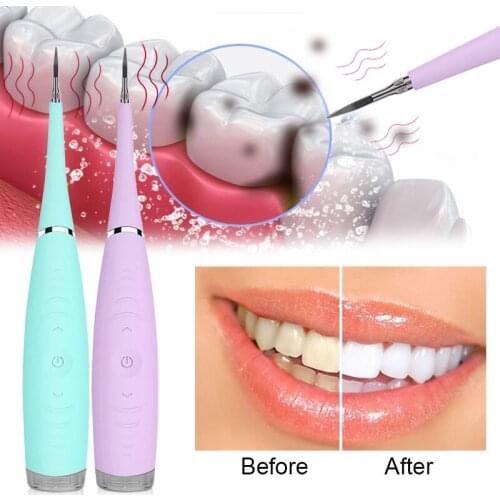 Usb Upload Vibrition Sonic Dental Scaler Tooth Tooth Stone Remove tooth Spots Tooth Stone Cleaner Hygiene Dentist Tool Bleaching