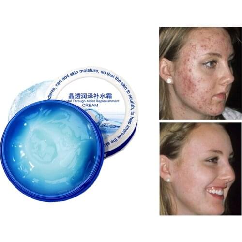 Top quality Snail 100% Essence hyaluronic acid liquid whitening spot essence shrink pores ampoule anti-acne Delay ageing essence