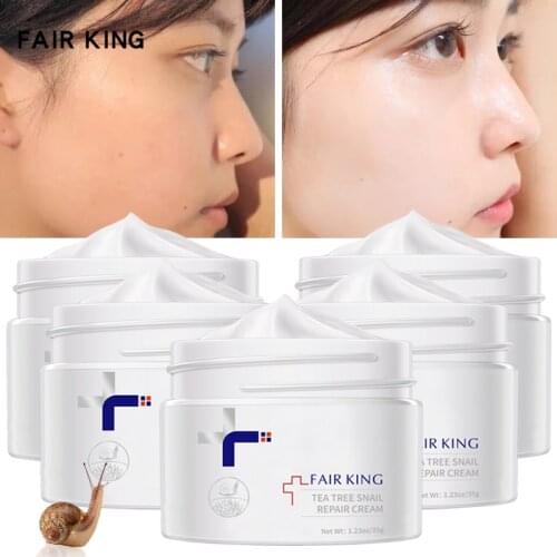 FAIRKING Retinol Firming Snail Face Cream Moisturizer Whitening Facial Skin Care Hyaluronic Acid Anti-aging Nourishing Day Cream