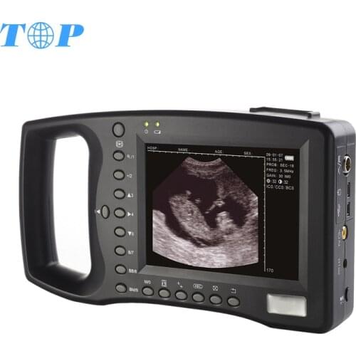 TOP-A1009 Farm vet handheld ultrasound machine veterinary portable