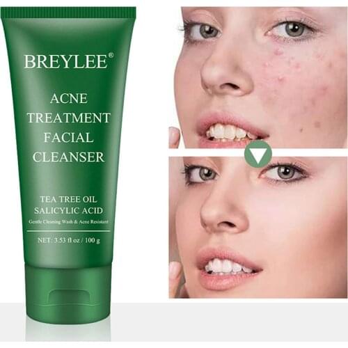 Acne Treatment Facial Cleanser Tea Tree Oil Remove Pimple Face Detergent Oil Control Remove Aged Cutin Face Wash Cream 100g