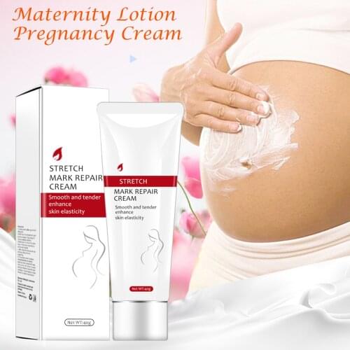 2019 40ml Non-irritating Stretch Mark Cream Scar Slack Line Repairing for Pregnant Woman