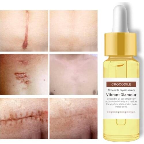 1pcs Crocodile Peptide Face Serum Moisturizing Anti Wrinkle Anti-Aging Remove Scar Repair Damaged Skin Facial Skin Care TSLM2