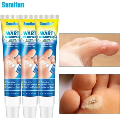 3Pcs Sumifun Warts Remover Ointment Foot Corns Plaster Wart Treatment Antibacterial Cream Herbs Extract Skin Tags Removal
