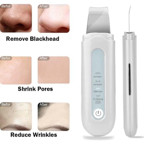 Ultrasonic Skin Scrubber Vibration Face Spatula Blackhead Remover Facial Scrubber Shovel Clean Cavitation Peeling Shovel tool