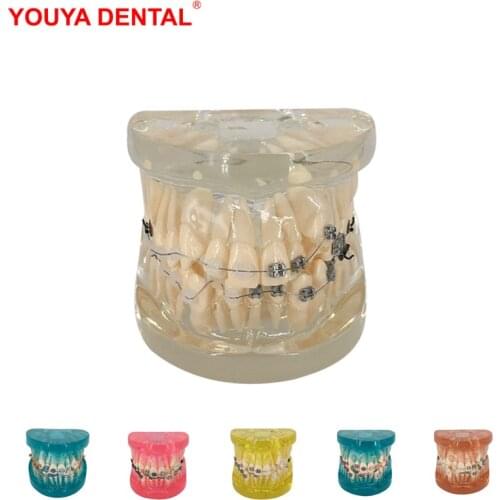 Dental Orthodontic Model With Ortho Half Ceramic Half Metal Bracket Teeth Model Dental Orthodontic Treatment Models Dentist Tool