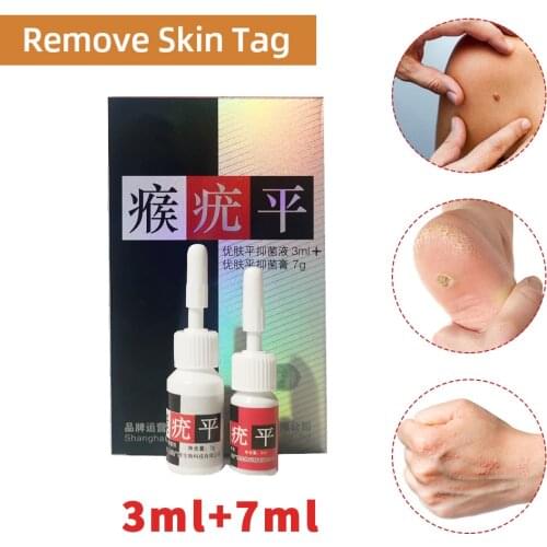 Hot sale Chinese Traditional Medicine Treatment Adult Foot Corn Removal Plantar Genital Warts Ointment Foot Care Medical Plaster