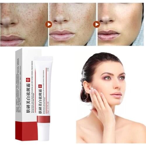 Effective Acne Treatment Acne Removal Cream Fade Acne Oil Pores Shrink Control Moisturizing Cream Spots Repair Whitening E8E9
