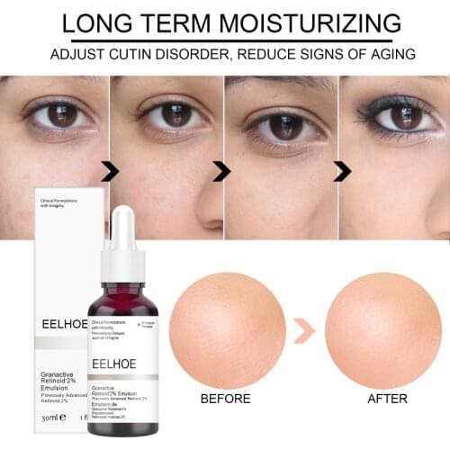 Salicylic Acid Mask Facial Serum AHA 30%+ BHA 2% Remove Acne Scars Essence Niacinamide Hyaluronic Essence Face Serum TSLM1