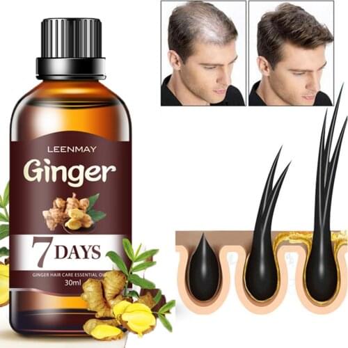 7 Days Fast Hair Growth Essence Oil Ginger Hair Growth Serum Nourish Treatment Hair Loss Repair Damaged Hair For Men Women 30ml