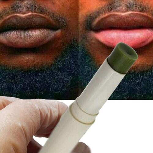 Natural lip balm can be used to lighten the dark lips of men and women