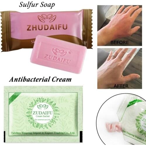 1PC zudaifu Sulfur Soap add 1PC zudaifu Psoriasis Cream Dermatitis Eczematoid Eczema Ointment Treatment Skin Psoriasis