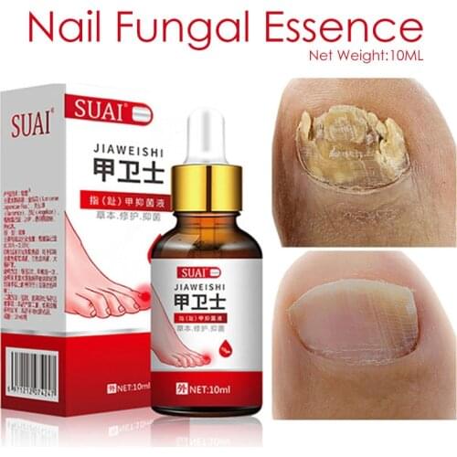 Effective Fungus Removal Essence oil Liquid Fungal Nail Treatment Bright Nail Repair Anti Infection Foot Caring Onychomycosis
