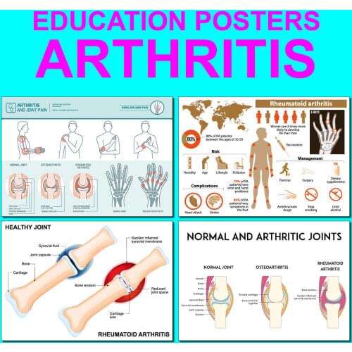 5style Choose EDUCATIONAL ARTHRITIS Art Film Print Silk Poster for Your Home Wall Decor 24x36inch