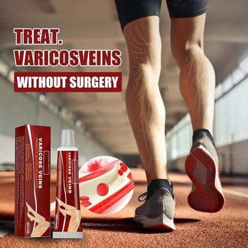 Hot Portable Varicose Vein Ointment Soothing Leg Swelling Multipurpose Body Massage Cream Easy to Use