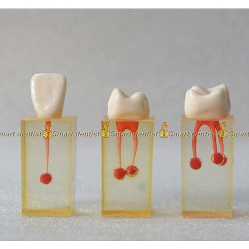 1 set x Resin Dental canal Endodontic Student Study Practice Operation Model with Colored Root Canal