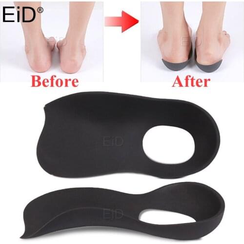 Unisex O/X Legs Correction Insoles Orthopedic Insole Arch Support Orthoses Pad Massaging Shoe Insert Foot Care Flat Foot Shoe