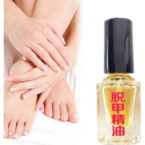 Liquid Fungal Nail Treatment Anti Infection Foot Caring Onychomycosis Bright Nail Repair Effective Fungus Removal Essence oil