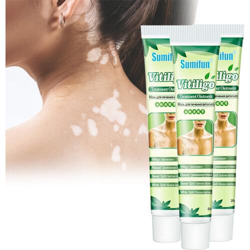 Sumifun New VitiligoTreament Cream Antibacterial Cream Psoriasis Localized Vitiligo Ointment Whitespot Mycosis Leukoplakia Treat