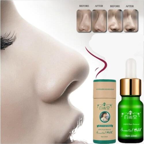 Nose Up Heighten Rhinoplasty Essential Oil 30ml Nasal Bone Rmodeling Pure Natural Nose Care Thin Smaller Nose 100% Effective