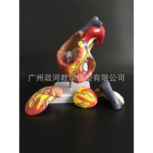 2x Human Body Medical Anatomical Model Heart Model Magnified Ventricular Atrium Cardiovascular Blood Circulation 4Parts