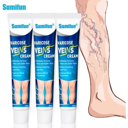 Sumifun 3pcs Varicose Veins Treatment Cream Vasculitis Phlebitis Spider Cream Varicosity Angiitis Removal Medical Plaster