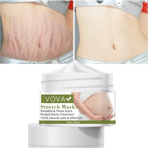 VOVA Repair Scar Cream Skin Care Body Cream Stretch Marks Repair Cream Removal Scar Marks Pregnancy Cream Fade Scald Scar Striae