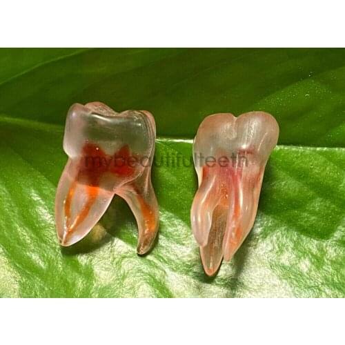 1~100Pis Dental Blocks Files Practice Cuspid Pulp Root Canal Molar Replicas Upper