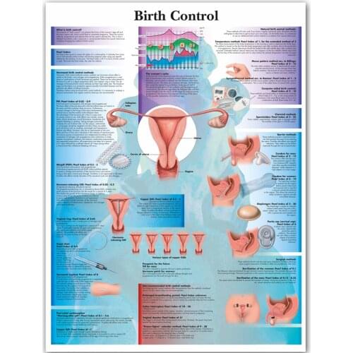 WANGART Birth Control Art Poster Print Body Map Canvas Wall Pictures for Medical Education Home Decor