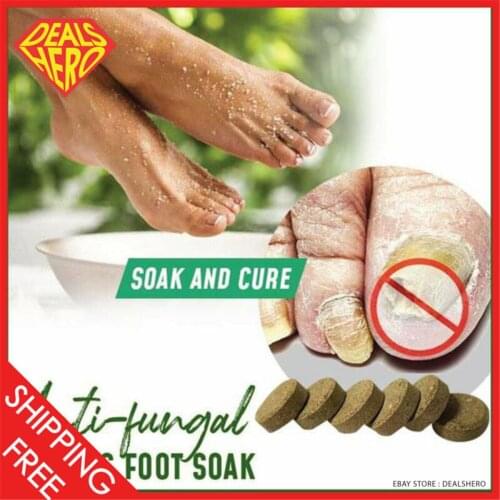 Anti-fungal Peeling Foot Soak Nail Treatment Cracking Detox Long-Term Relief