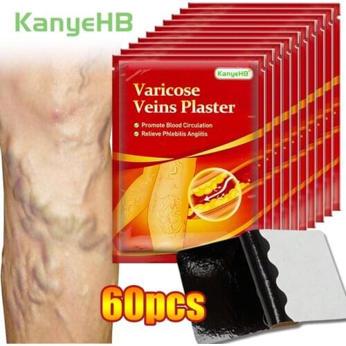 60pcs/10bag Varicose Veins Ointmnet plaster Vasculitis Phlebitis Spider Patch Varicosity Angiitis Removal Herbal Medical Sticker