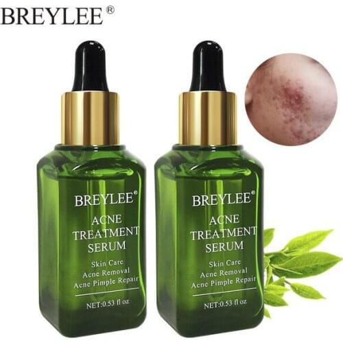 BREYLEE Acne Treatment Essence Whitening Anti Acne Scar Removal Face Cream Repair Pimple Remover For Acne Serum Skin Care 2 pcs