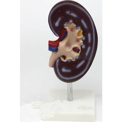 One anatomical model of kidney