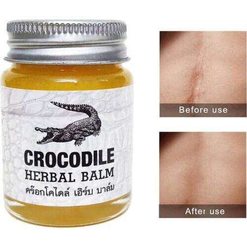 1 Bottle Thai Crocodile Cream Thailand Herbal Balm Cream Stretch Acne Corrector Pigmentation Marks Remover Whitening Face S D7U3
