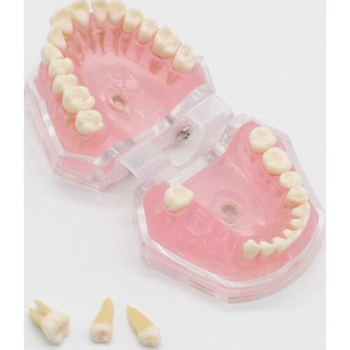 Dental Standard Model with Removable Teeth Dentistry Study Teach