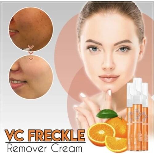 VC FRECKLE REMOVER CREAM