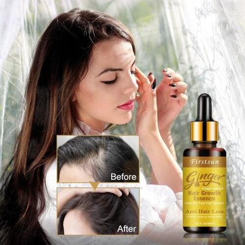 30ML Effictive Ginger Hair Growth Serum for Women Anti Preventing Hair Loss Alopecia Liquid Damaged Hair Repair Growing Faster