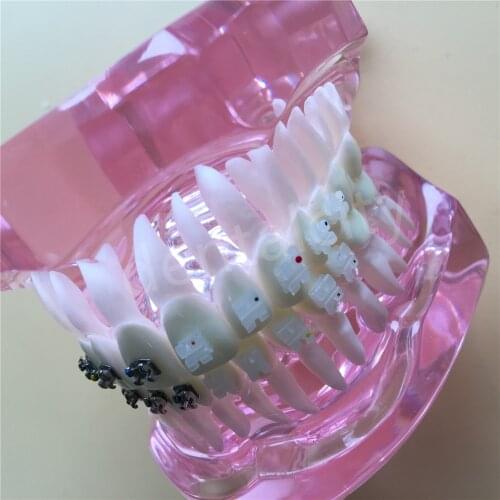 Dental Orthodontic Model with Metal and Ceramic Brackets Dental Teeth Study Model 3003 Pink