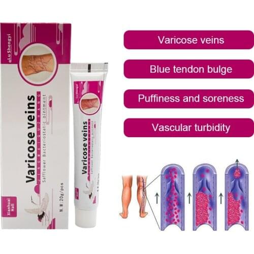 Varicose Veins Blue Tendon Bulge Puffiness And Soreness Vascular Turbidity Treatment Cream Ointment Removal Phlebitis Legs