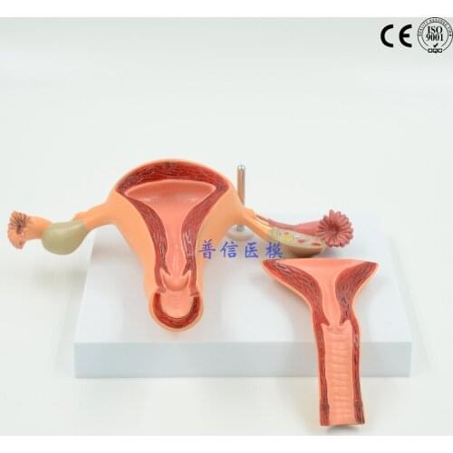 DongYun brand Uterus anatomical model female internal genital organs model Medical Science teaching supplies