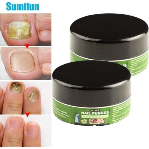 10g Nail Thickening Cream Soft Ringworm Cream Gray Nail Inhibiting Cream Antibacterial Toenail Cream Herbal Toenail Fungus P0159
