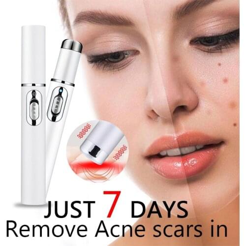 Acne Laser Pen Portable Wrinkle Removal Machine Durable Soft Scar Remover Device Blue Light Therapy Pen Massage Relax