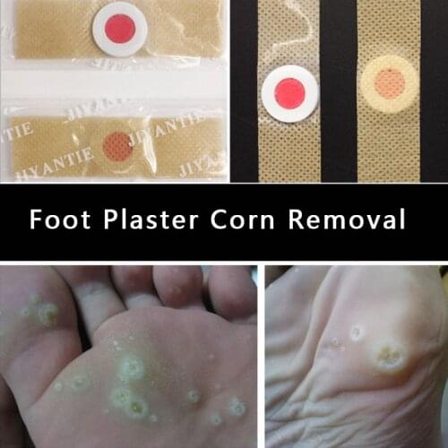 40pcs Medical Foot Plaster Corn Removal Pads Warts Thorn Patch Feet Curative Chicken Eye Treatment Sticker Calluses Detox