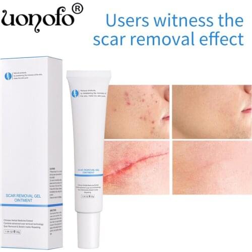 Best Herbal Acne Scar Removal Cream Pimples Stretch Marks Face Gel Remove Acne Smoothing Whitening Moisturizing Body Skin Care